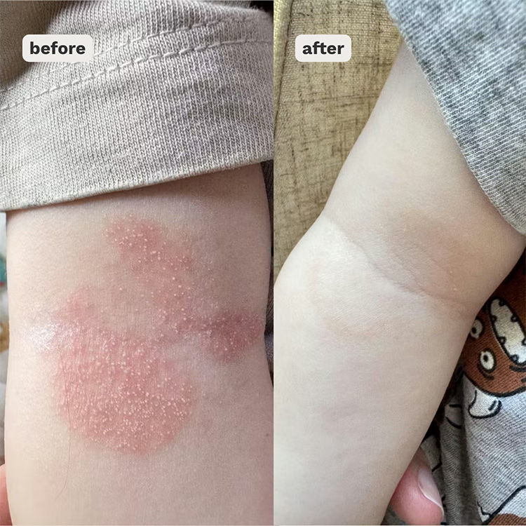 Shield Balm