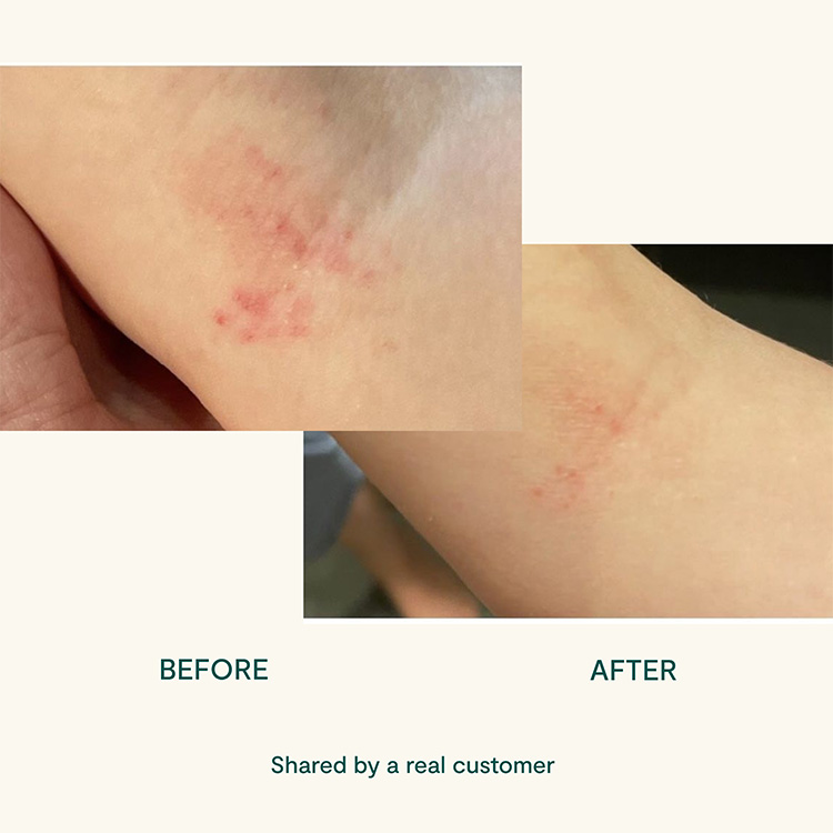 BEETL Baby balm